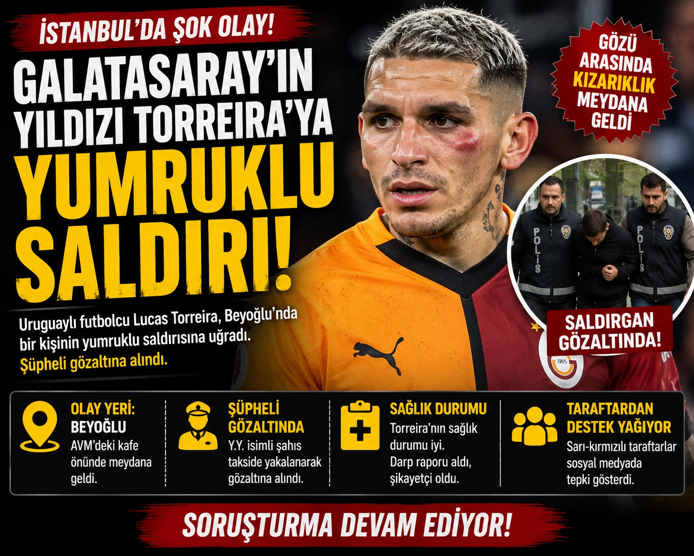 Galatasaray&rsquo;ın Yıldızı Torreira&rsquo;ya Yumruklu Saldırı!